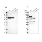 Western blot analysis using Anti-NOP58 antibody HPA018472 (A) shows similar pattern to independent antibody HPA021062 (B).