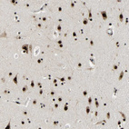 Immunohistochemical staining of human cerebral cortex shows strong positivity in nuclear speckles in neurons.