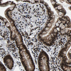 Immunohistochemical staining of human colon shows strong nuclear positivity in glandular cells.