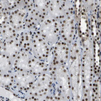 Immunohistochemical staining of human kidney shows strong positivity in nuclear speckles in cells in tubules.