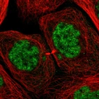Immunofluorescent staining of human cell line A-431 shows localization to nuclear speckles.