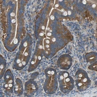 Anti-AIMP1 Antibody