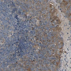 Immunohistochemical staining of human tonsil shows strong cytoplasmic positivity in squamous epithelial cells.