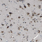 Immunohistochemical staining of human cerebral cortex shows strong cytoplasmic positivity in neurons.