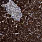 Anti-AK2 Antibody