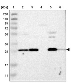 Lane 1: Marker [kDa] 230, 130, 95, 72, 56, 36, 28, 17, 11_br/_Lane 2: Human cell line RT-4_br/_Lane 3: Human cell line U-251MG sp_br/_Lane 4: Human plasma (IgG/HSA depleted)_br/_Lane 5: Human liver tissue_br/_Lane 6: Human tonsil tissue