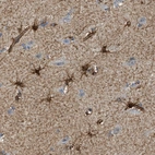 Immunohistochemical staining of human cerebral cortex shows strong cytoplasmic positivity in glial cells.