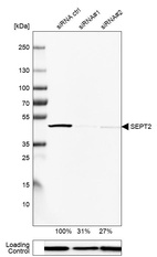 Western blot analysis in U-251MG cells transfected with control siRNA, target specific siRNA probe #1 and #2, using Anti-SEPT2 antibody. Remaining relative intensity is presented. Loading control: Anti-PPIB.