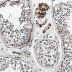 Immunohistochemical staining of human testis shows strong granular cytoplasmic positivity in Leydig cells.