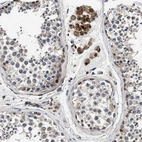 Immunohistochemical staining of human testis shows strong granular cytoplasmic positivity in Leydig cells.