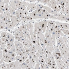 Immunohistochemical staining of human heart muscle shows strong granular cytoplasmic positivity in cardiomyocytes.