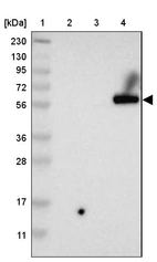 Lane 1: Marker [kDa] 230, 130, 95, 72, 56, 36, 28, 17, 11_br/_Lane 2: Human cell line RT-4_br/_Lane 3: Human cell line U-251MG sp_br/_Lane 4: Human plasma (IgG/HSA depleted)