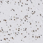Immunohistochemical staining of human cerebral cortex shows strong nuclear positivity in neurons.