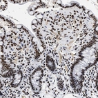 Immunohistochemical staining of human colon shows strong nuclear positivity in glandular cells.