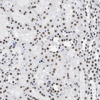 Immunohistochemical staining of human kidney shows strong nuclear positivity in cells in tubules.