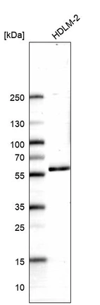 Western blot analysis in human cell line HDLM-2.