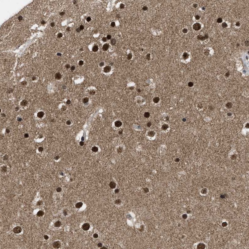 Anti-ZNF346 Antibody