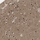 Anti-ZNF346 Antibody