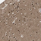 Anti-ZNF346 Antibody