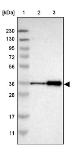 Lane 1: Marker [kDa] 230, 130, 95, 72, 56, 36, 28, 17, 11_br/_Lane 2: Human cell line RT-4_br/_Lane 3: Human cell line U-251MG sp