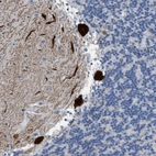 Anti-PDE1B Antibody