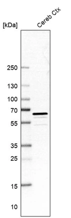 Western blot analysis in human cerebral cortex tissue.