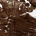 Immunohistochemical staining of human skeletal muscle shows strong cytoplasmic positivity in myocytes.