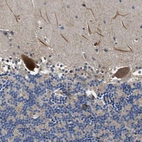 Immunohistochemical staining of human cerebellum shows strong cytoplasmic positivity in Purkinje cells.