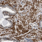 Immunohistochemical staining of human prostate shows strong cytoplasmic positivity in smooth muscle cells.