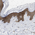 Immunohistochemical staining of human skin shows moderate cytoplasmic positivity in squamous epithelial cells.