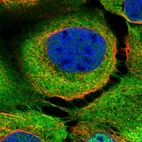 Immunofluorescent staining of human cell line A-431 shows localization to plasma membrane & cytosol.
