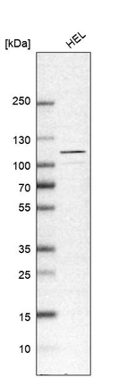 Western blot analysis in human cell line HEL.