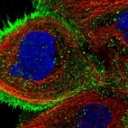 Immunofluorescent staining of human cell line A-431 shows localization to plasma membrane & cytosol.