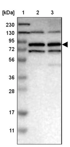 Lane 1: Marker [kDa] 230, 130, 95, 72, 56, 36, 28, 17, 11_br/_Lane 2: Human cell line RT-4_br/_Lane 3: Human cell line U-251MG sp