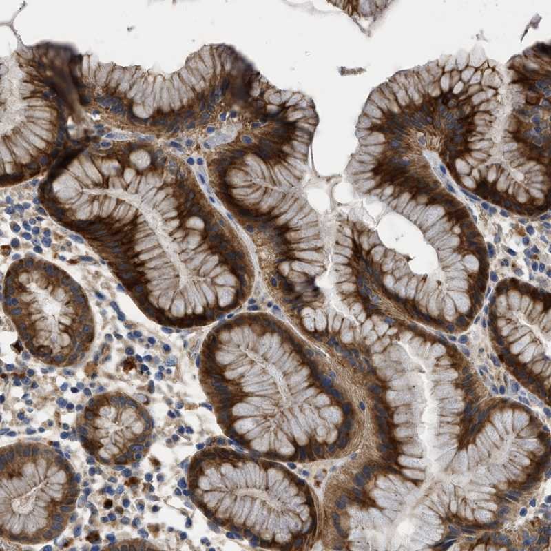 Anti-CSRNP2 Antibody