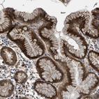 Anti-CSRNP2 Antibody