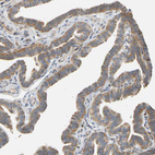 Anti-RPS14 Antibody