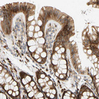 Immunohistochemical staining of human colon shows moderate to strong cytoplasmic positivity in glandular cells.