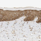 Immunohistochemical staining of human skin shows moderate cytoplasmic positivity in squamous epithelial cells.