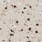 Immunohistochemical staining of human cerebral cortex shows strong cytoplasmic positivity in neurons.