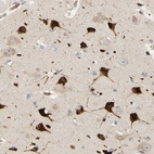 Immunohistochemical staining of human cerebral cortex shows strong cytoplasmic positivity in neurons.