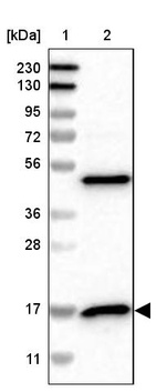 Lane 1: Marker [kDa] 230, 130, 95, 72, 56, 36, 28, 17, 11_br/_Lane 2: Human cell line RT-4