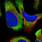 Immunofluorescent staining of human cell line U-2 OS shows localization to cytosol & endoplasmic reticulum.