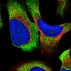 Immunofluorescent staining of human cell line U-2 OS shows localization to cytosol & endoplasmic reticulum.