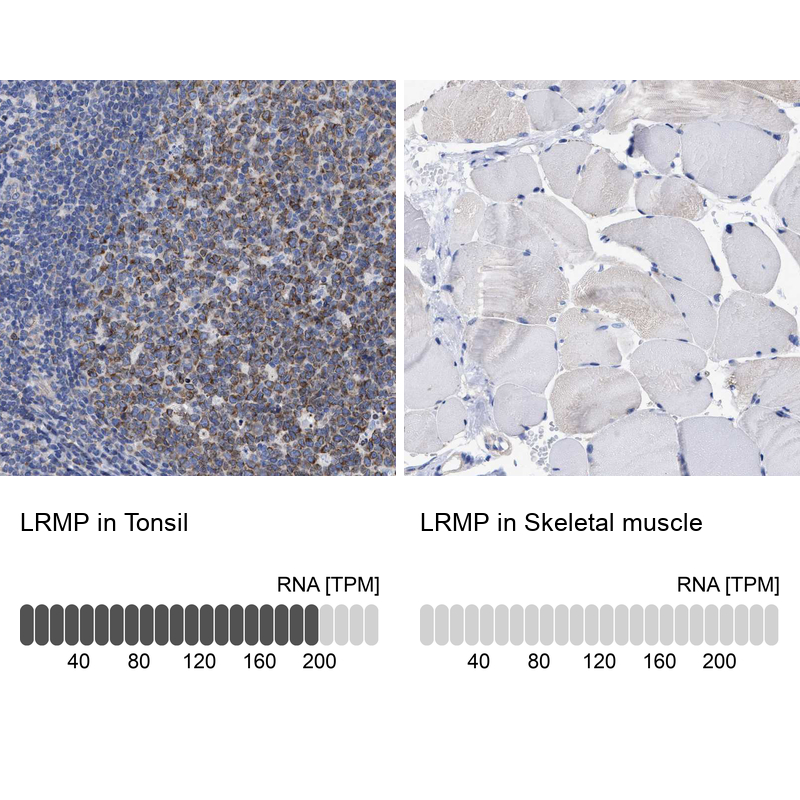 Anti-LRMP Antibody
