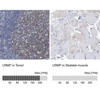 Anti-LRMP Antibody