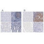 Immunohistochemical staining of human liver, lymphoid tissues, skeletal muscle and upper gastrointestinal using Anti-LRMP antibody HPA018505 (A) shows similar protein distribution across tissues to independent antibody HPA002967 (B).
