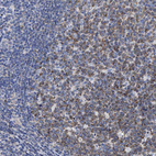 Immunohistochemical staining of human tonsil shows strong membranous positivity in germinal center cells.