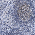 Immunohistochemical staining of human lymphoid tissues shows strong membranous positivity in germinal center cells.