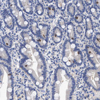 Immunohistochemical staining of human duodenum shows strong membranous positivity in enteroendocrine cells.